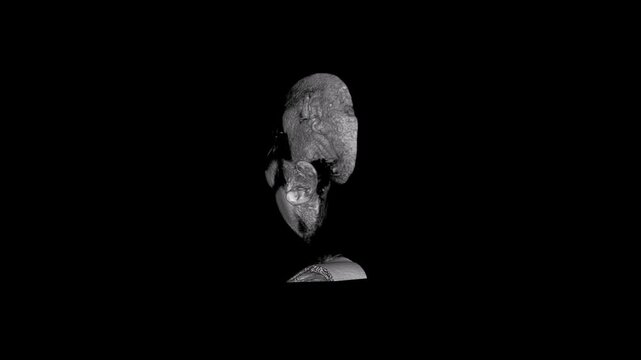 3D Volumetric Mid-Sagittal Cut MRI Brain Reconstruction Showing Deep Brain Structures Brainstem and Facial Profile