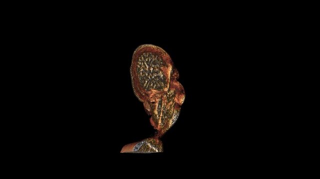 Cinematic Sagittal Section MRI Scan Volume Rendering Displaying Human Brain Internal Hemispheres and Head Profile Anatomy