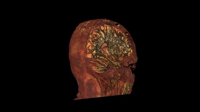 3D MRI Volume Rendering Profile Showing Human Head Surface Facial Features Brain Hemispheres and Cerebellum Anatomy