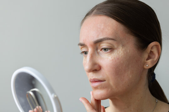 Woman looking at mirror on her face just after painful beauty injections.