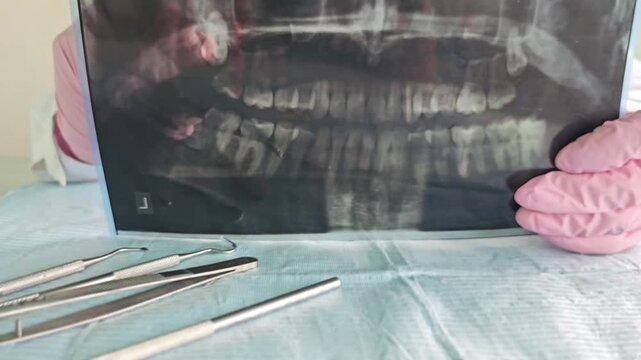 Dentist shows dental x-ray and tools used for tooth extraction at clinic