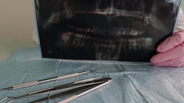 Dental examination of an X-ray showing teeth with tools for cleaning and examination