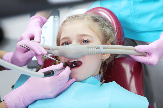 Dental treatment in child with sedation. Little girl is injected with an inhalation sedative during dental treatment at dental clinic.