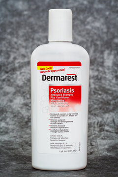 Pleasant Valley Canada - June 23, 2026: Bottle of Dermarest medicated shampoo. The Dermarest brand is currently owned by Prestige Consumer Healthcare.