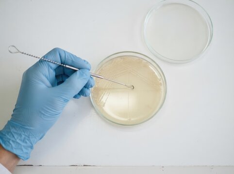 Scientist in blue gloves inoculating a petri dish with a bacteriological loop in a microbiology laboratory