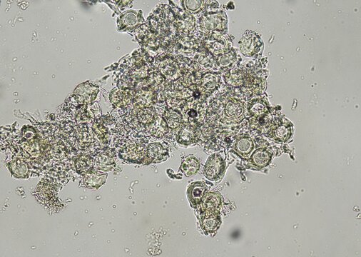soil microorganisms under a microscope including amoeba, flagellates, nematodes, fungi, bacteria	