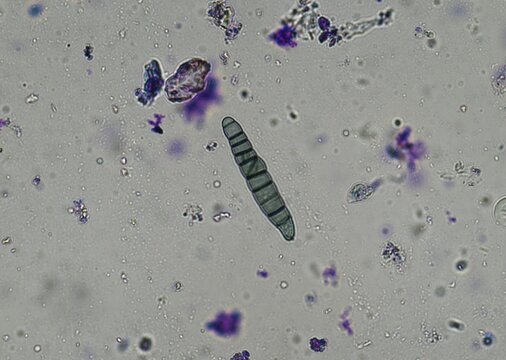 soil microorganisms under a microscope including amoeba, flagellates, nematodes, fungi, bacteria	