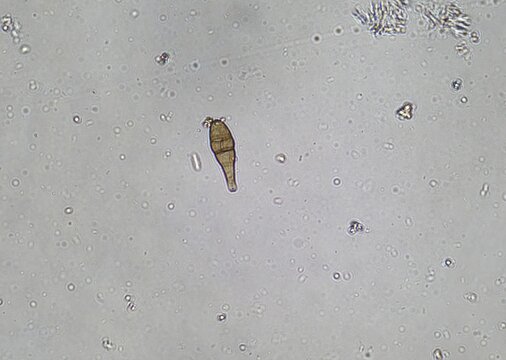 soil microorganisms under a microscope including amoeba, flagellates, nematodes, fungi, bacteria	