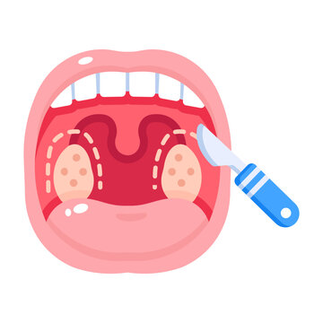 Flat open-mouth icon showing tonsil treatment with a surgical tool.