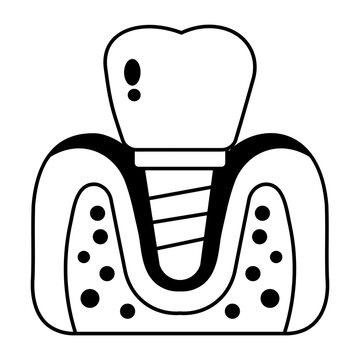 Glyph tooth and gum icon showing a dental implant screw.