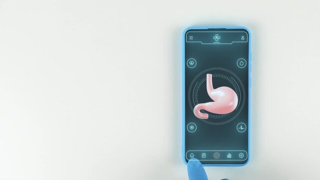 Smartphone con interfaz m&eacute;dica para el registro de s&iacute;ntomas de gastritis, &uacute;lceras y reflujo gastroesof&aacute;gico. Prevenci&oacute;n gastroenterol&oacute;gica digital. Mano con guante azul claro sobre fondo blanco.