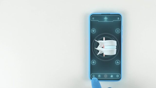 Mobile telemedicine application for monitoring herniated discs and managing spinal rehabilitation exercises. Modern digital medicine concept. Hand with light blue glove on a white background.