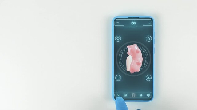 Mobile telemedicine application for monitoring polycystic kidney disease and controlling kidney cysts. Modern digital medicine concept. Hand with light blue glove on a white background.