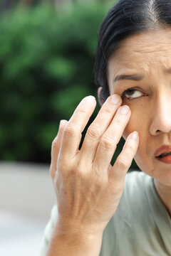 Middle aged Asian woman touching eyelid bump old aged health condition, face closeup shot