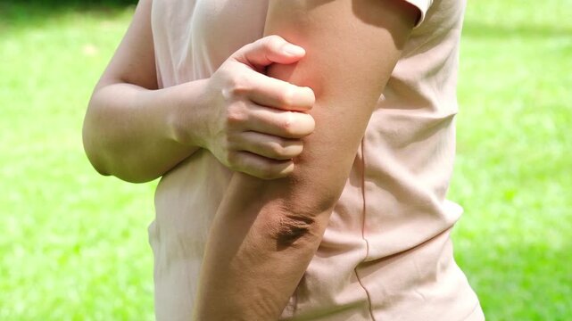 Woman was scratching her arm because she had a skin problem and was itchy from a fungal infection. Concept regarding health and skincare.