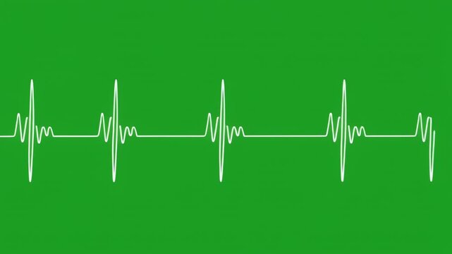 Heartbeat EKG waveform pulses on green screen background with black screen transitions medical concept