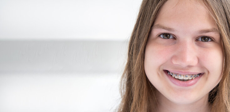 Smiling teen girl with metal braces on gray background, copy space. Person smiling showing teeth, orthodontic treatment concept. Horizontal dental care banner