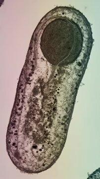 Infectious agent detail: Clostridium tetani, microorganism view, tetanus disease, lockjaw symptom, spore reproduce, toxin release, bacillus form, microbe cause, human illness.