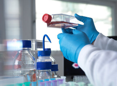 Pharmaceutical research into infectious disease and pandemics, Scientist viewing cells in a jar during a clinical trial