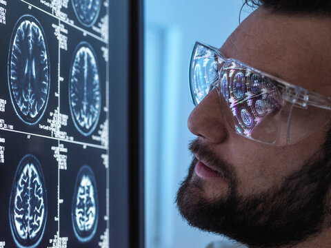 Doctor wearing eyeglasses analyzing brain scan