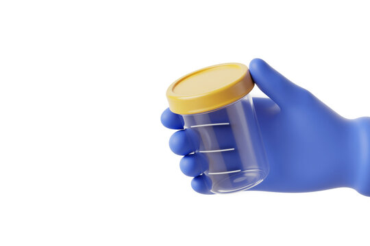 Blue Nitrile Glove Holding Clear Specimen Container with Yellow Lid