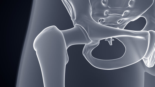 Anatomy of hip joint Xray Microscopy 3d illustration
