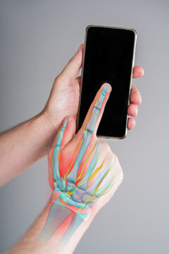 Pain thumb and index finger with illustration anatomical joint, bones, nerves and red backlight. Trigger finger, gaming thumb or carpal tunnel syndrome
