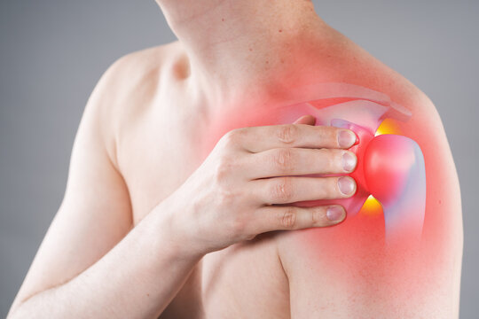 Man shirtless with pain arm, painful area highlighted in red, graphic bones and shoulder joint. Concept dislocation, inflammation and arthritis