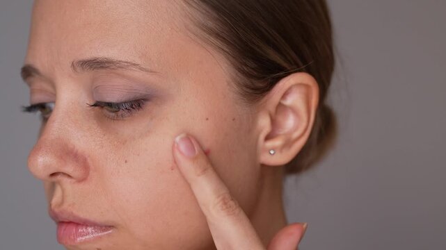 Young woman dabbing cream onto cheek blemish, demonstrating targeted acne care and facial skin treatment at home on gray background