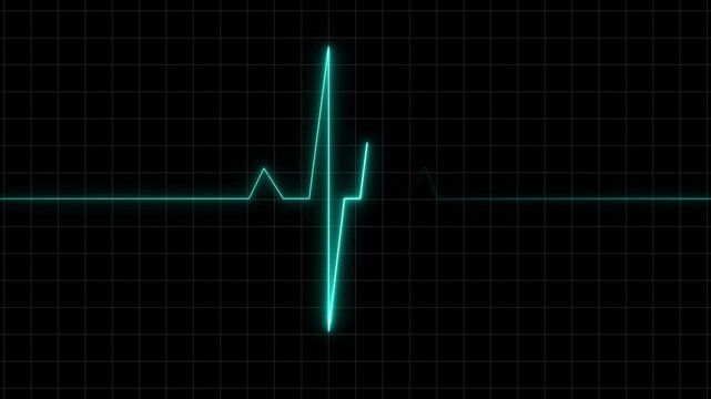 Neon blue heartbeat pulse animation displays cardiogram ECG lines. Heartbeat pulse medical display features glowing EKG rhythm graphs. Pulse animation layout is clean.