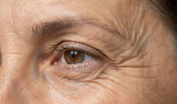 Close up of mature woman eye area with deep wrinkles and crow's feet