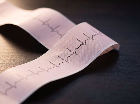 Macro Detail of Electrocardiogram Paper Strip Showing Abstract Rhythmic Trace Lines Over Fine Grid