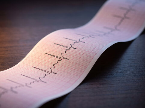 Macro Detail of Electrocardiogram Paper Strip Showing Abstract Rhythmic Trace Lines Over Fine Grid