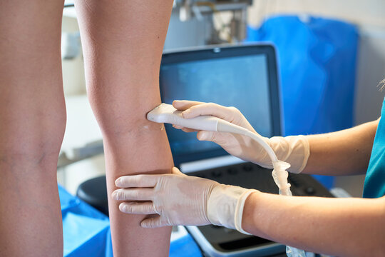 Doctor performs ultrasound scan of leg veins on female patient to diagnose venous insufficiency. Phlebology Ultrasound Diagnostic