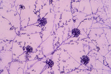 Naklejka premium Microscope image showing branching fungal hyphae with dense spore clusters, illustrating mycology, microbiology, laboratory diagnostics, fungal infections, and biological research.