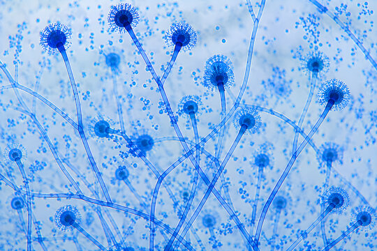 Microscopic blue-stained Aspergillus showing conidiophores and spore heads, representing fungal biology, laboratory diagnostics, and medical microbiology research.