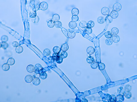 Light microscope image showing branching fungal hyphae with spherical spores, illustrating mold reproduction, mycology, laboratory diagnostics, and microbiological research.