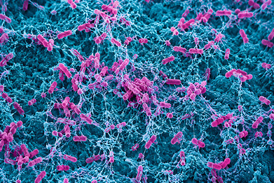 Scanning electron microscope image of rod-shaped bacteria attached within a biofilm matrix, highlighting microbial adhesion, infection, and biomedical research.