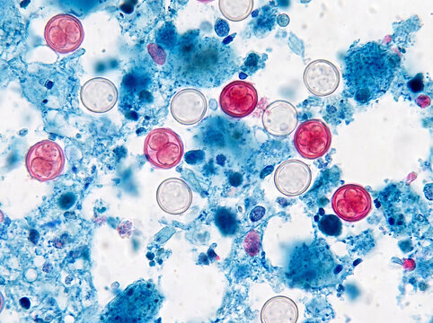 Coccidia oocysts on blue background, microscopic view for medical research