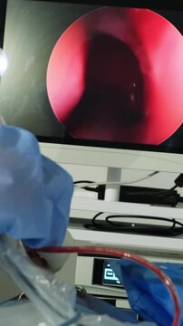 Laparoscopy surgery procedure demonstration on device screen closeup. Doctor conducts invasive treatment of patient in hospital vertical shot