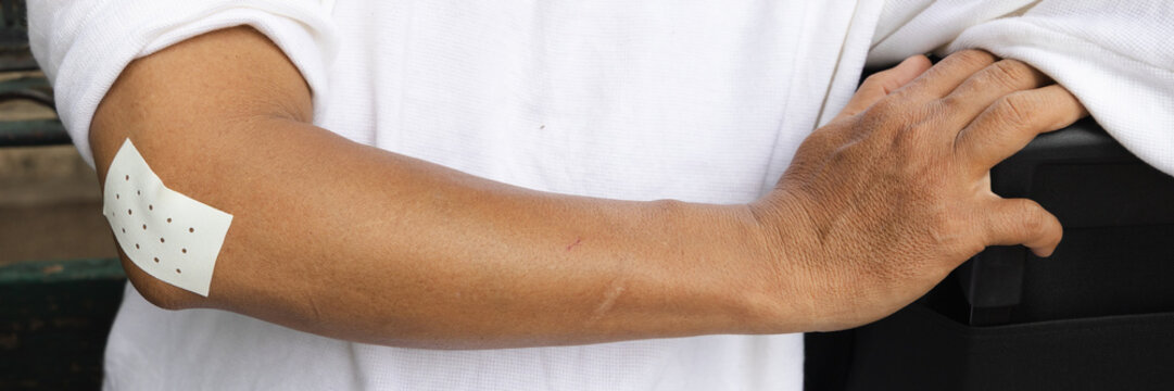 elderly asian man wearing a pain relief patch on his elbow for tennis elbow, front view close up medical shot