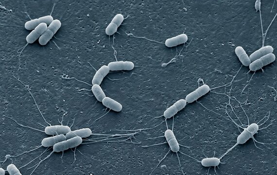 Scanning electron micrograph of rod-shaped bacteria with flagella on a textured surface
