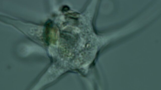 Amoeba radiosa at 100x under brightfield microscopy