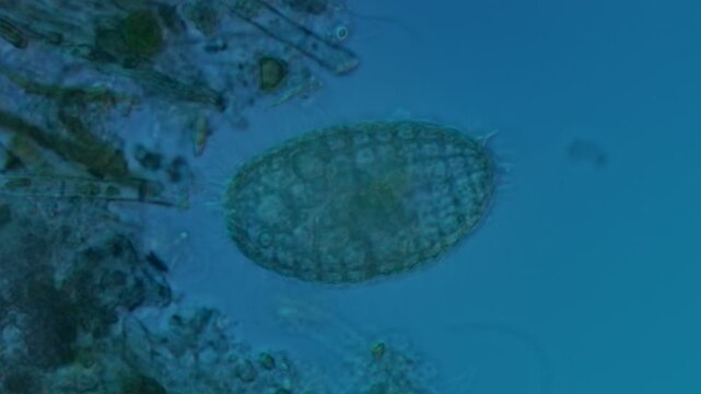Coleps hirtus ciliate at 50x under Nomarski DIC microscopy