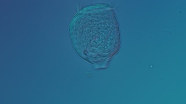 Vorticellid telotroch at 50x under Nomarski DIC microscopy