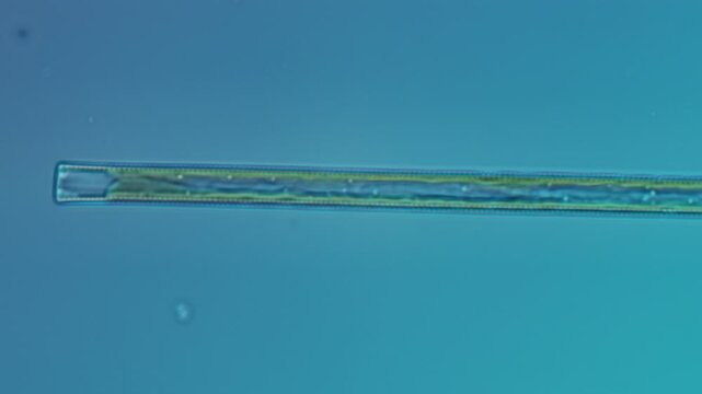 Ulnaria sp. diatom at 50x under Nomarski DIC microscopy