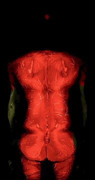 Vertical medical animation of a whole body MRI T2 fat saturated study rendered in glowing red and orange tones scrolling through coronal slices on black.