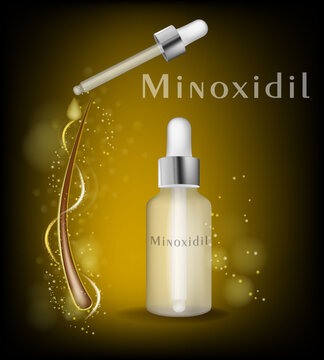 Modern medical vector illustration of a topical minoxidil solution in a dropper bottle with a pipette dispensing serum onto a hair follicle. The composition symbolizes hair loss treatment