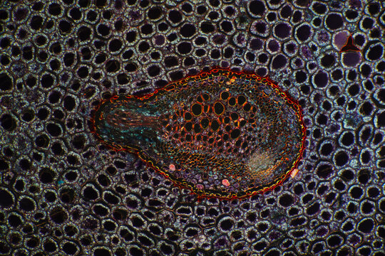 Micrograph of Plant Stem Parenchyma Cells