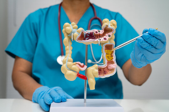 Intestine, appendix and digestive system, doctor holding anatomy model for study diagnosis and treatment in hospital.